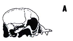 Skull A