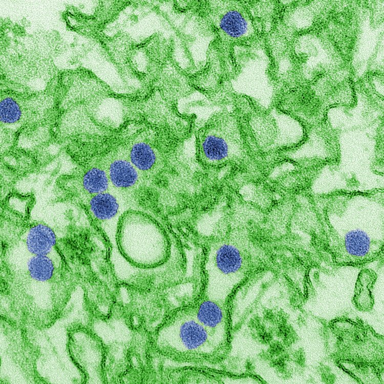 Electron micrograph of zika virus