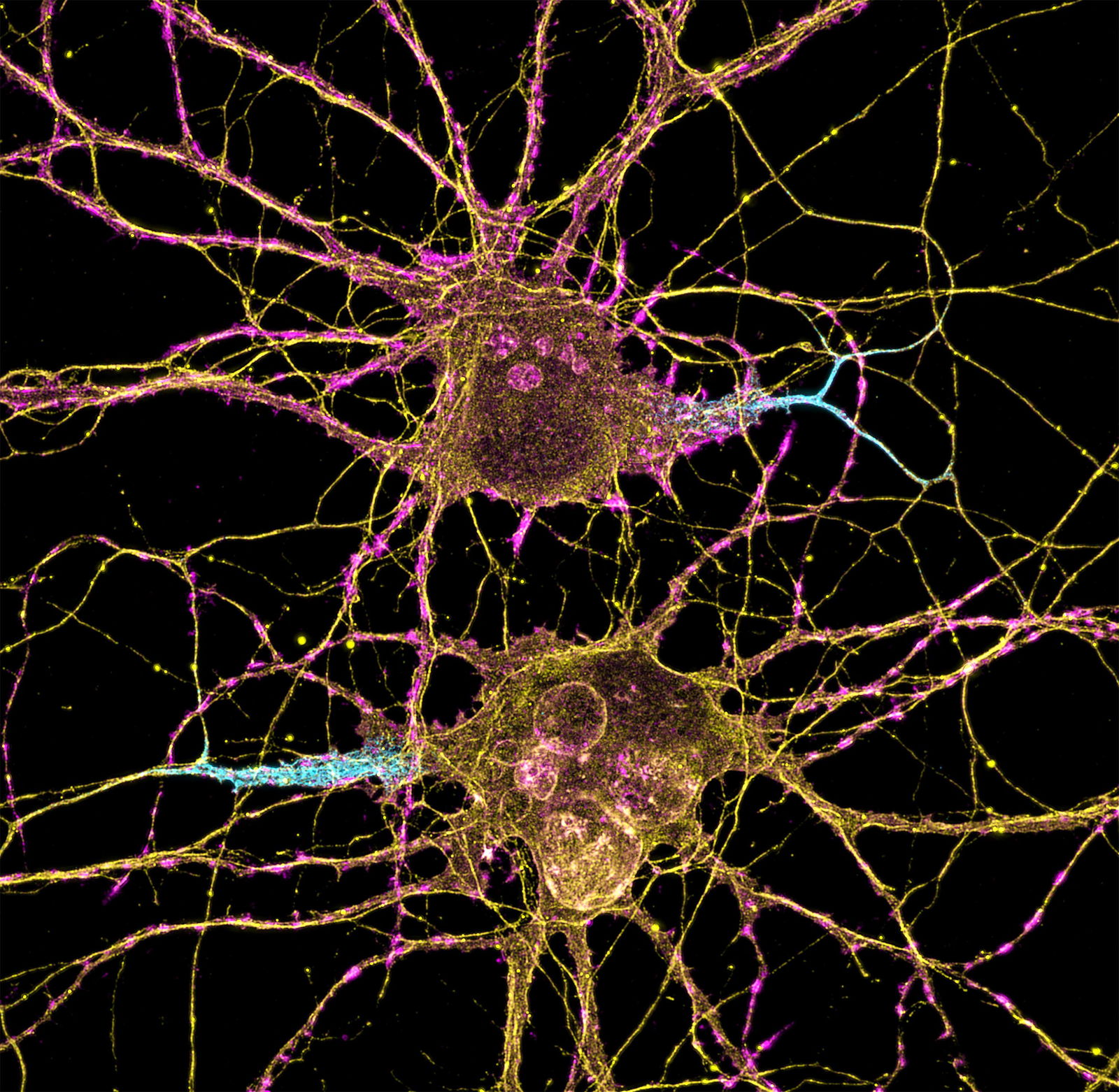 neurons