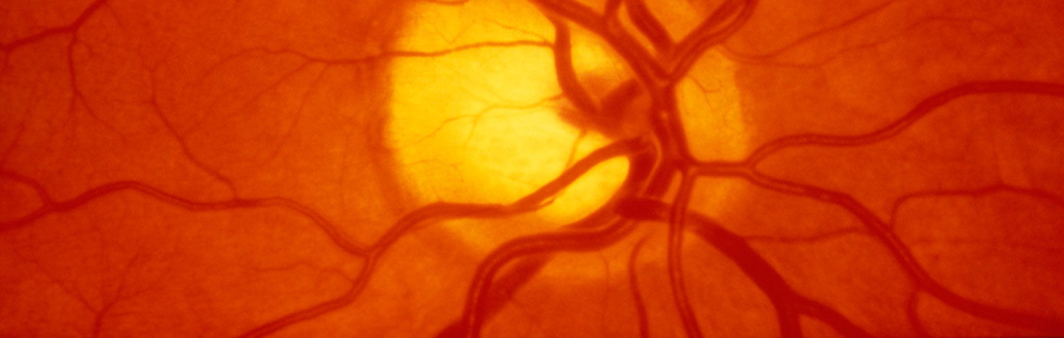 experiment-retinal-blood-vessels-hiding-in-plain-sight-answers-in