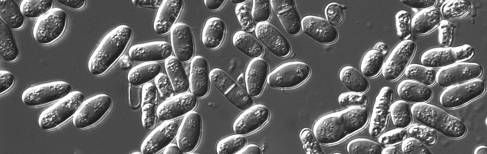 The Transformational Power of Yeasts: One-Celled Creatures That Burst with Life