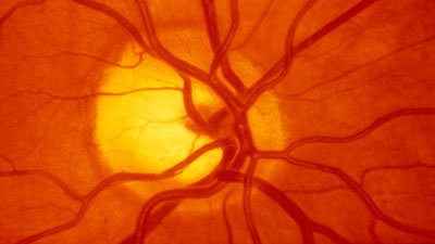Retinal Blood Vessels—Hiding in Plain Sight