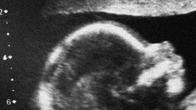 “I Can Make a Baby”—and Kill That Baby!