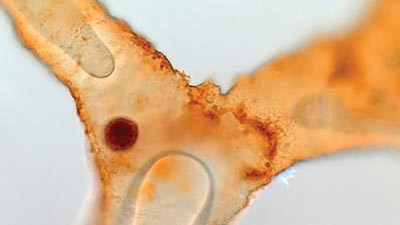 Soft Tissue in Fossils—Totally Compatible with Millions of Years?