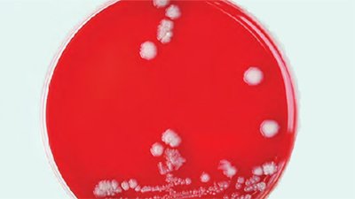 Bacteria in Your Home