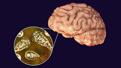 The Genesis of the “Brain-Eating” Amoeba