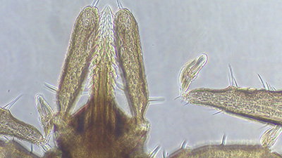 Bull’s-Eye on Borrelia:  A Commensal and Consequential Pathogen