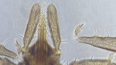 Bull’s-Eye on <i>Borrelia</i>:  A Commensal and Consequential Pathogen