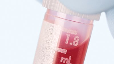 Stem Cell Research—Lifesaving Alternatives