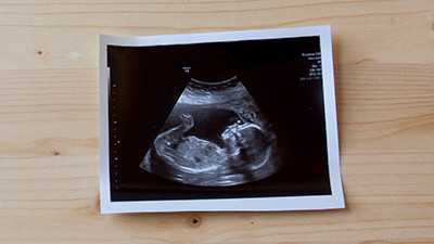 1 in 5 Churchgoers Have Participated in an Abortion