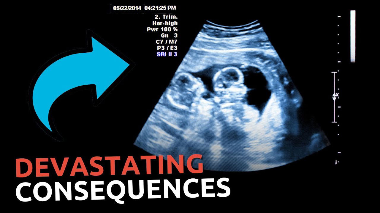 Woman on Hormone Therapy to Transition Found PREGNANT