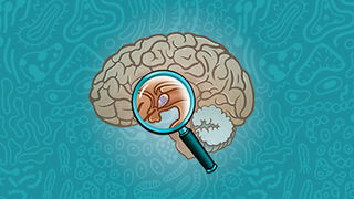 Hypothalamus