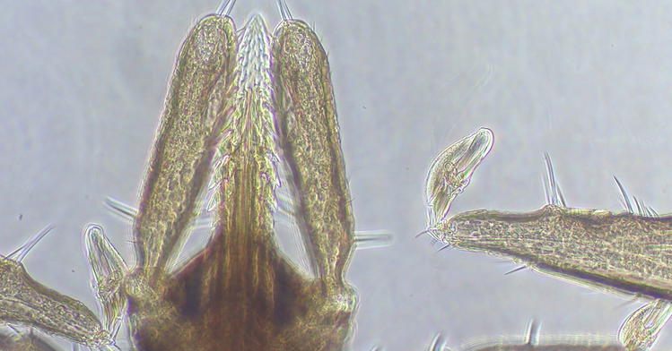 Bull’s-Eye on <i>Borrelia</i>:  A Commensal and Consequential Pathogen
