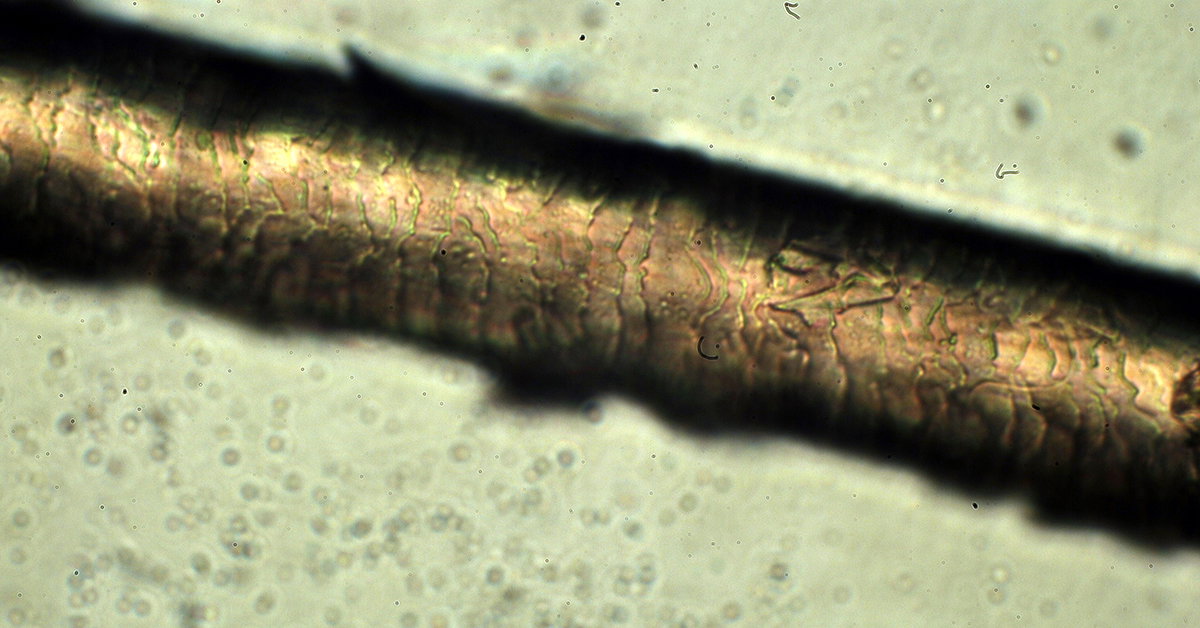 Dog Hair Under Microscope Labeled At Jason Weston Blog Dog Hair Under Microscope Labeled At Jason Weston Blog