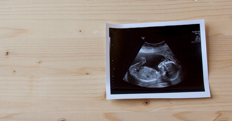 1 in 5 Churchgoers Have Participated in an Abortion