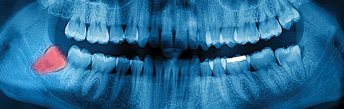 Evidence for Evolution?